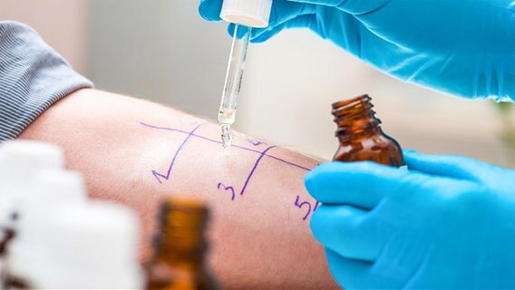 Allergietestmittel wird auf einem Arm getropft. © Fotolia.com Foto: Alexander Raths